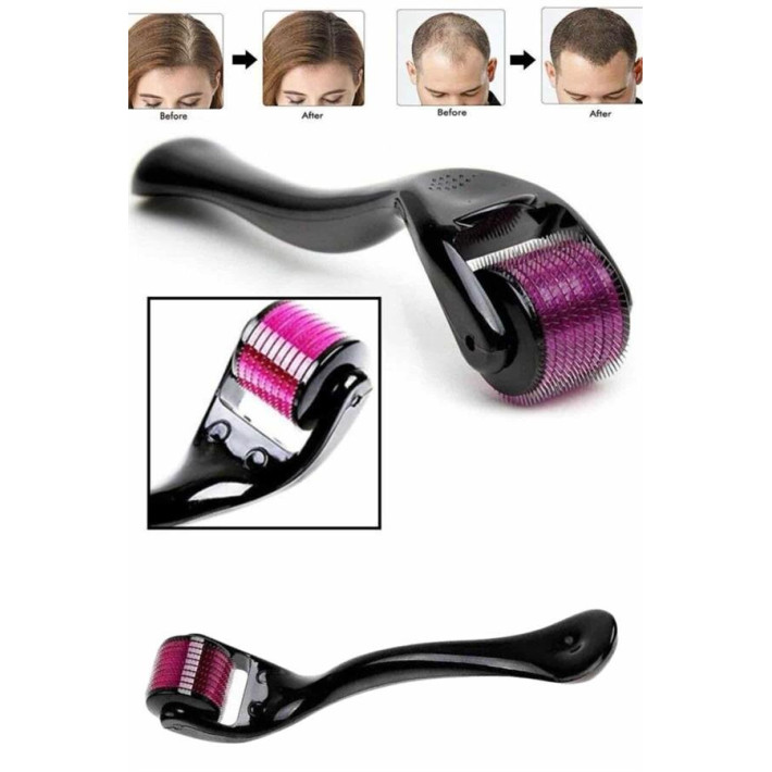 Derma Roller Titanyum Uçlu 540 İğneli 1 Mm Saç Sakal Çıkarma Ve Cilt B