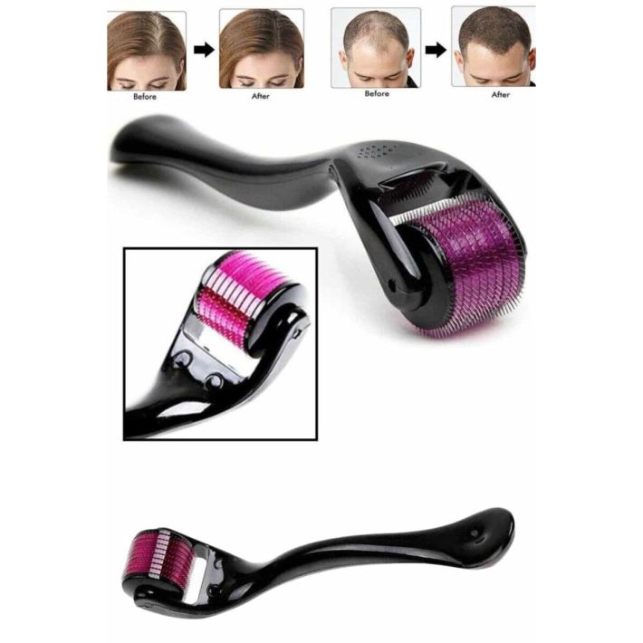 Derma Roller Titanyum Uçlu 540 İğneli 1 Mm Saç Sakal Çıkarma Ve Cilt B
