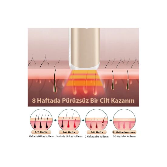 EZERE IPL Buz Lazer Epilasyon 999.999 Atim Otomatik/manuel Dokunmatik 