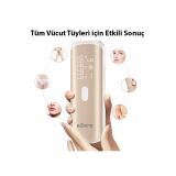 EZERE IPL Buz Lazer Epilasyon 999.999 Atim Otomatik/manuel Dokunmatik 