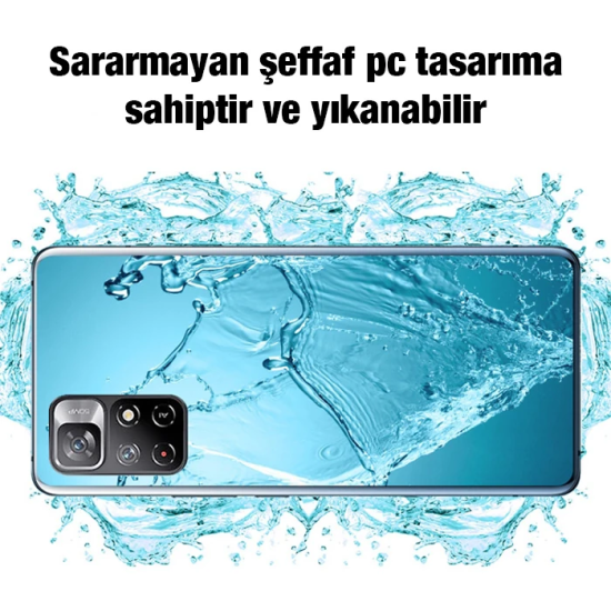 Ally Xiaomi Redmi Note 11 5G Kılıf Kamera Korumalı Ultra İnce Şeffaf S