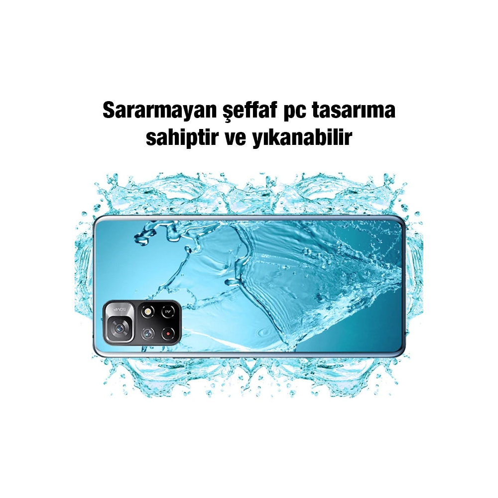 Ally Xiaomi Redmi Note 11 5G Kılıf Kamera Korumalı Ultra İnce Şeffaf S
