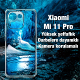 Ally Xiaomi Mi 11 Pro Kılıf Kamera Korumalı Ultra İnce Şeffaf Silikon 